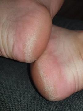 24P British rose soles and toes
