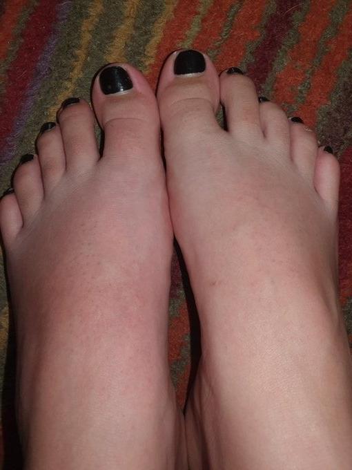 24P British rose soles and toes