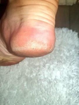 24P British rose soles and toes