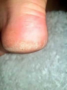 24P British rose soles and toes
