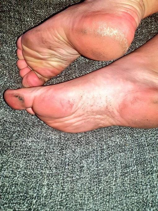 24P British rose soles and toes