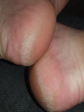 24P British rose soles and toes