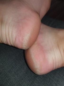 24P British rose soles and toes