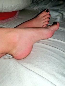 24P British rose soles and toes