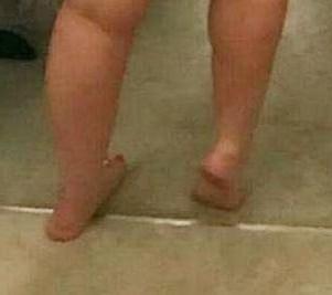 6P ANNA'S FEET