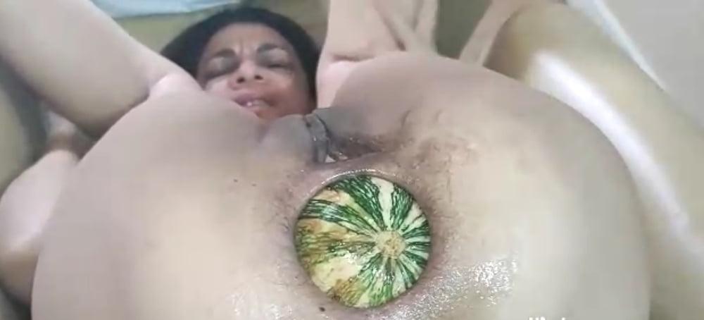 23P Huge bizarre insertions