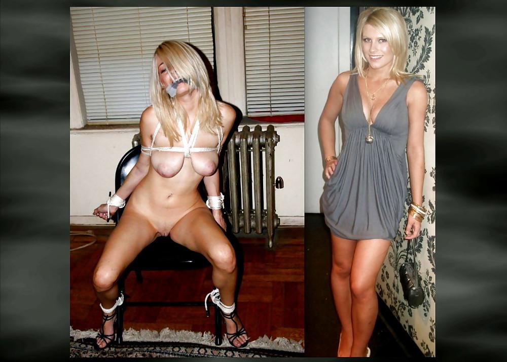 16P Before after torture