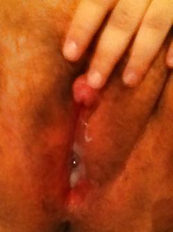 25P Female to Male trans