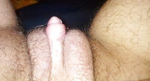25P Female to Male trans