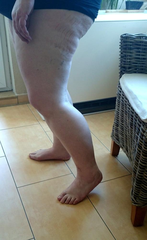 25P Sexy &amp; Chubby Legs 17