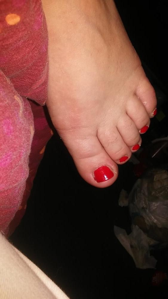 13P Plump feet