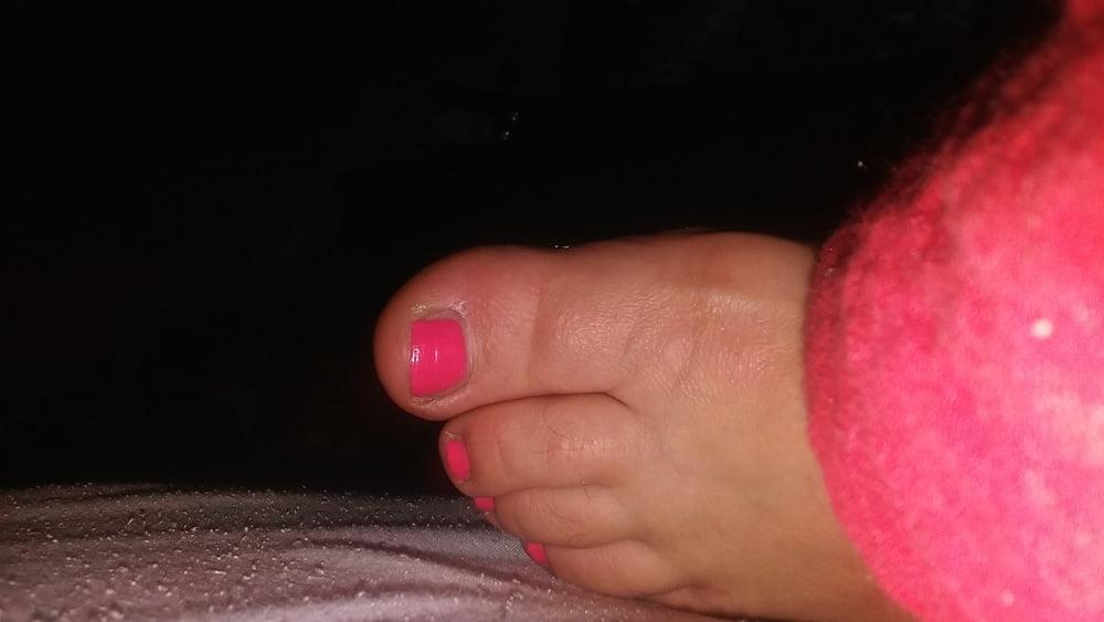 13P Plump feet