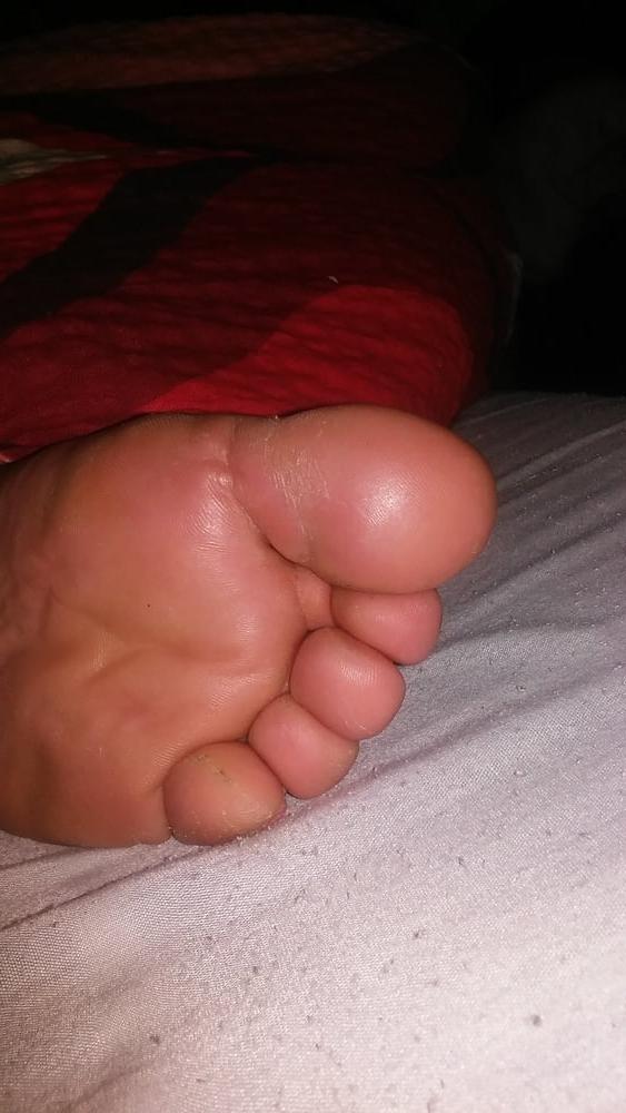 13P Plump feet