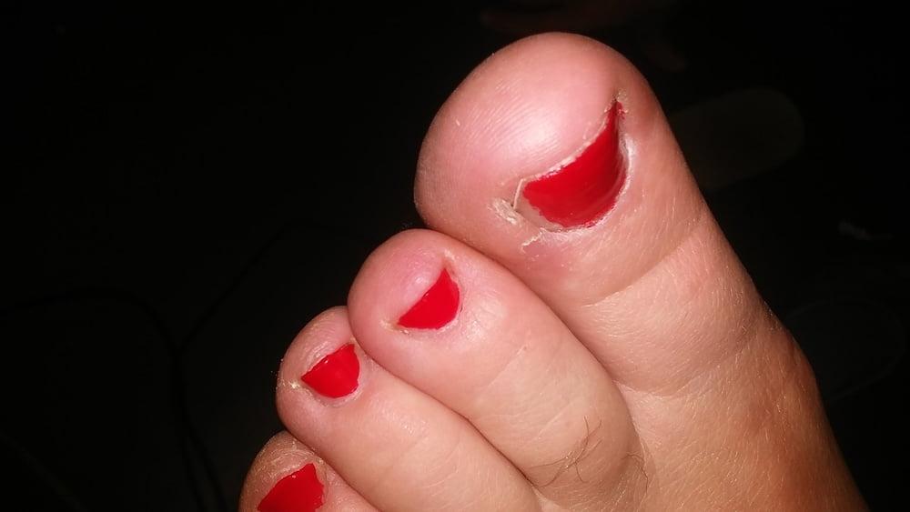 13P Plump feet