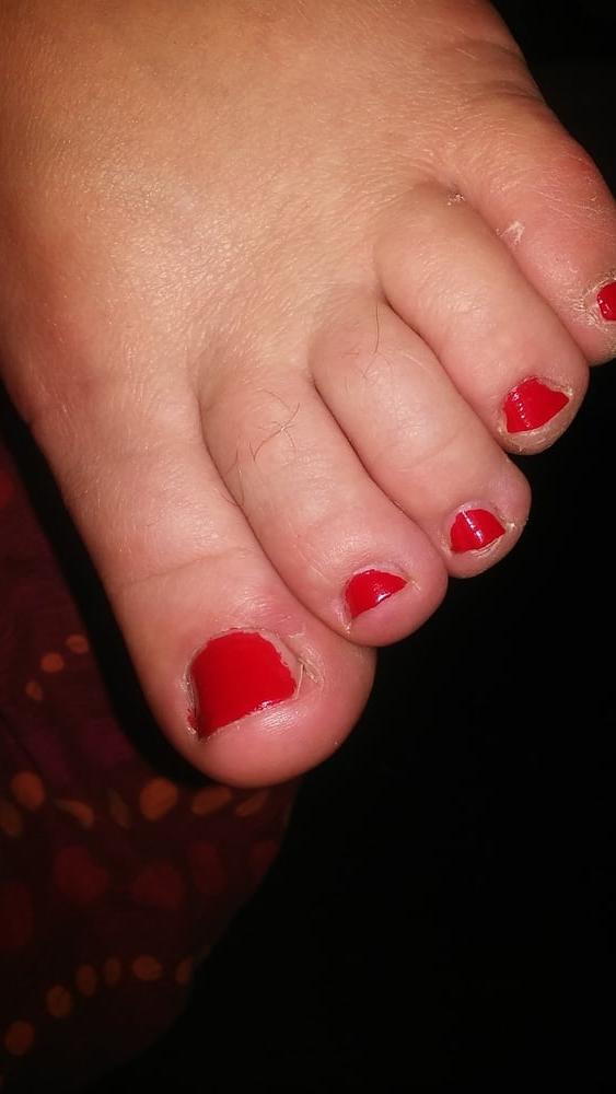 13P Plump feet