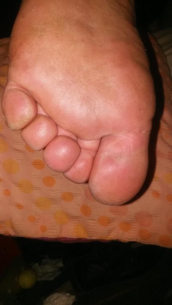 13P Plump feet