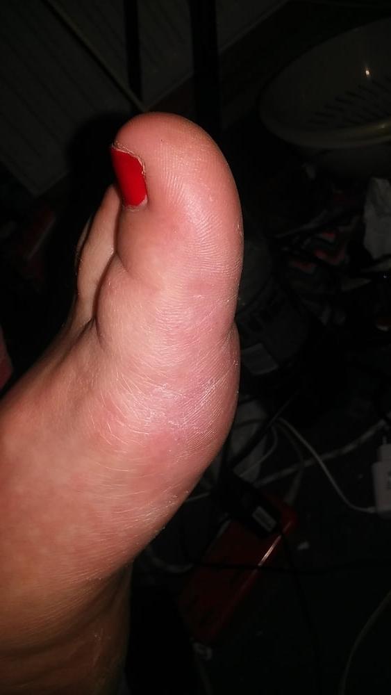 13P Plump feet