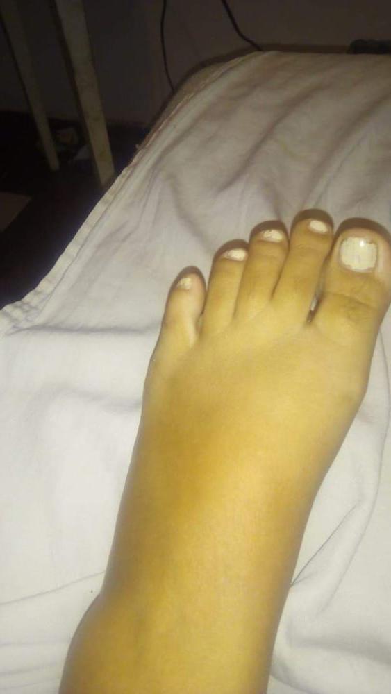 22P Maria feet 2
