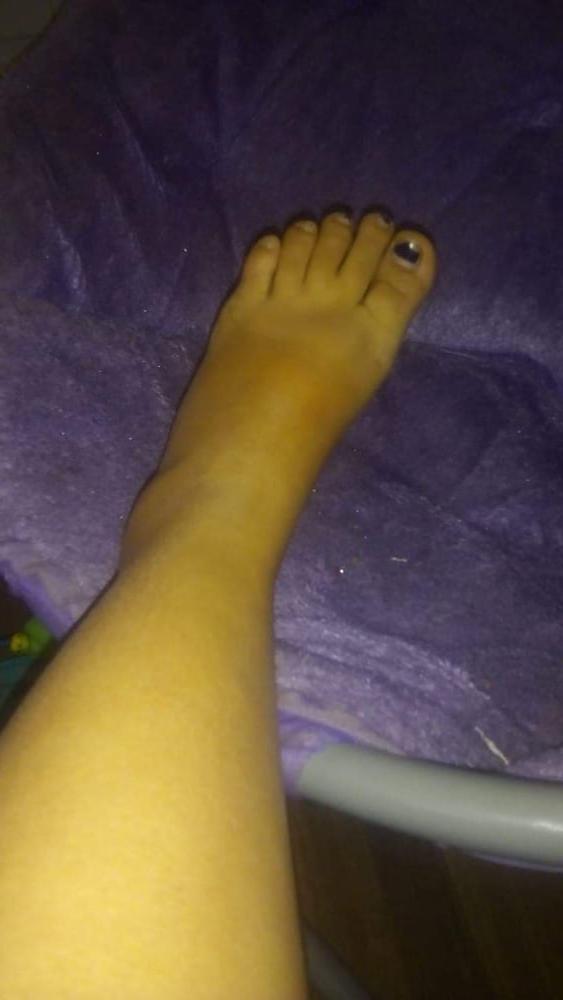 22P Maria feet 2