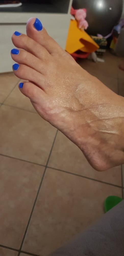 13P Piedini - feet