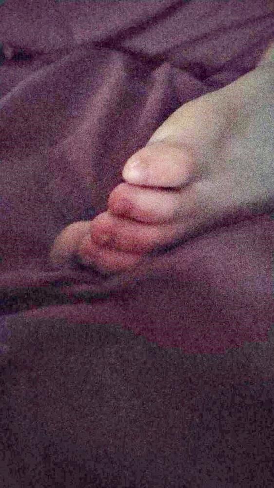 24P AMANDA'S FEET