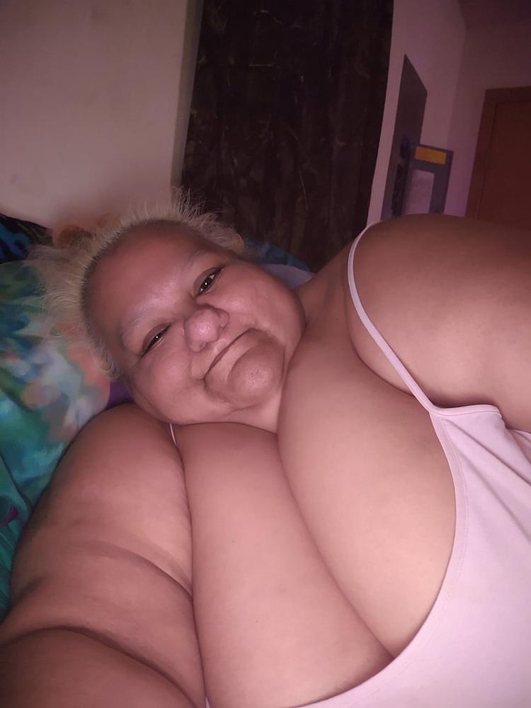 25P Hoodyman ssbbw 346 : Real humans exposed .