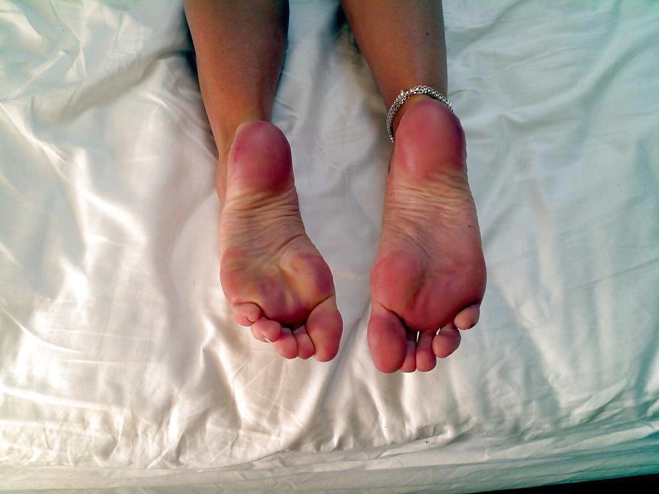 25P Scattered Feet
