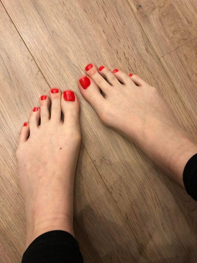 25P Scattered Feet