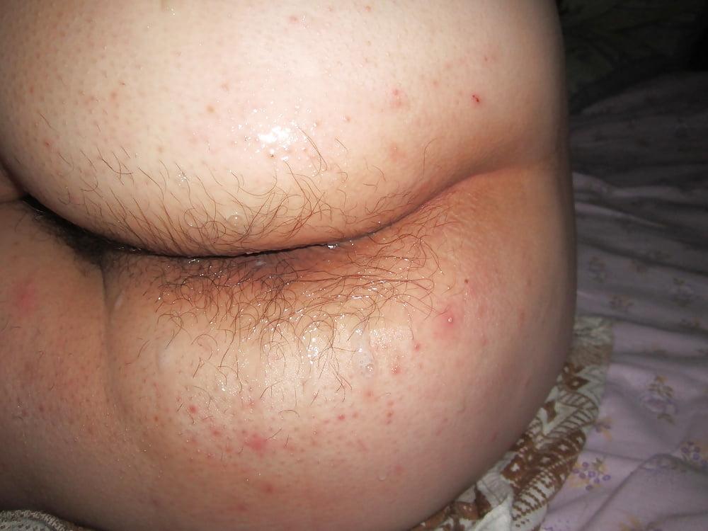 25P Real Women, Real Blemishes