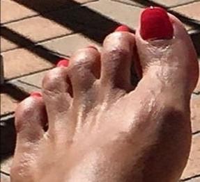 25P FEET
