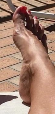 25P FEET