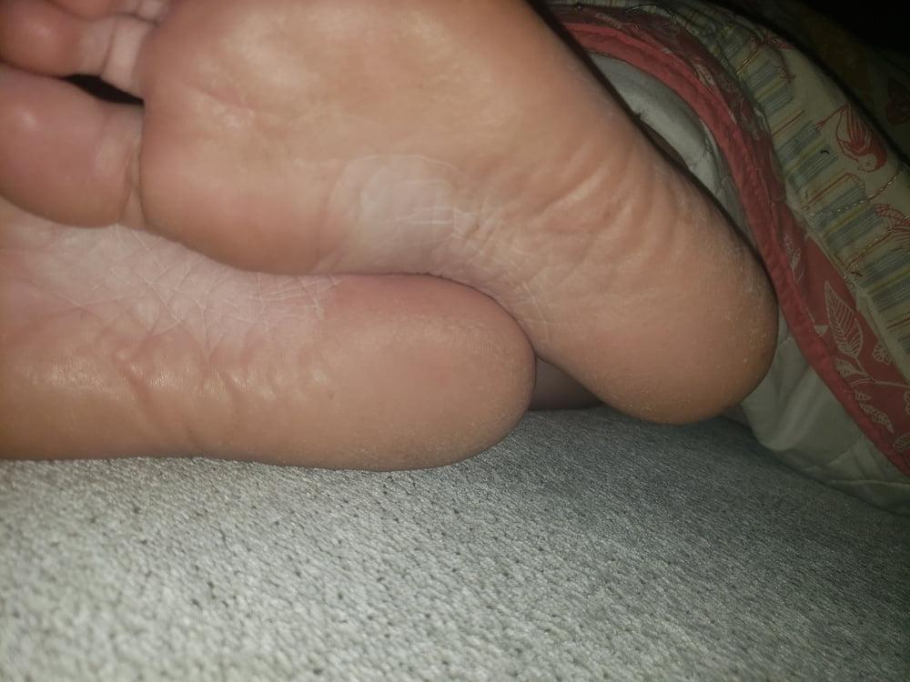 16P SEX FEET