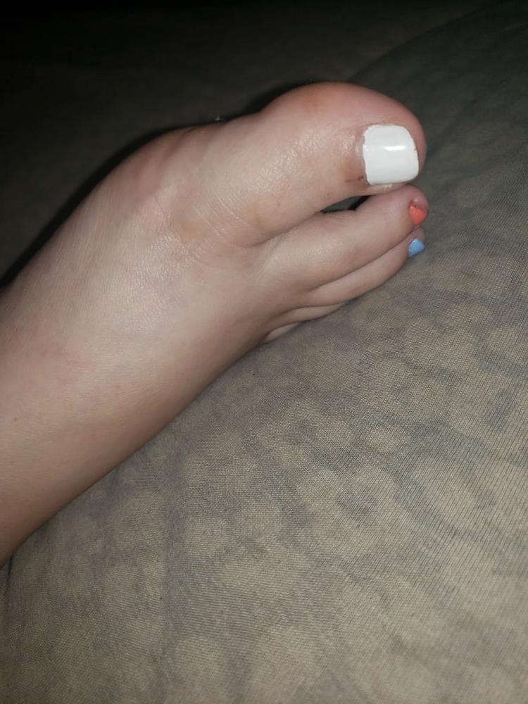 16P SEX FEET
