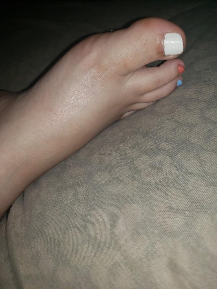 16P SEX FEET