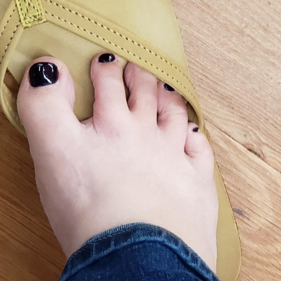 16P SEX FEET