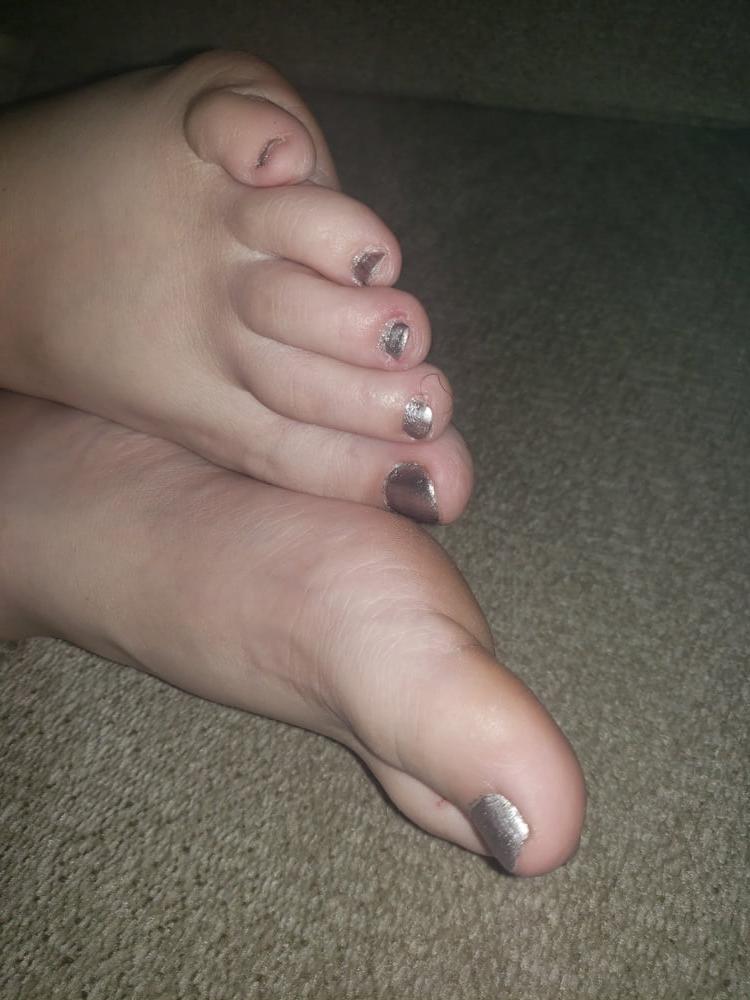 16P SEX FEET