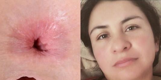 24P ass and face.. from Isaza39's page