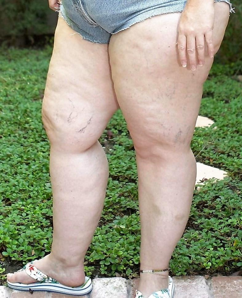 25P Sexy &amp; Chubby Legs 14