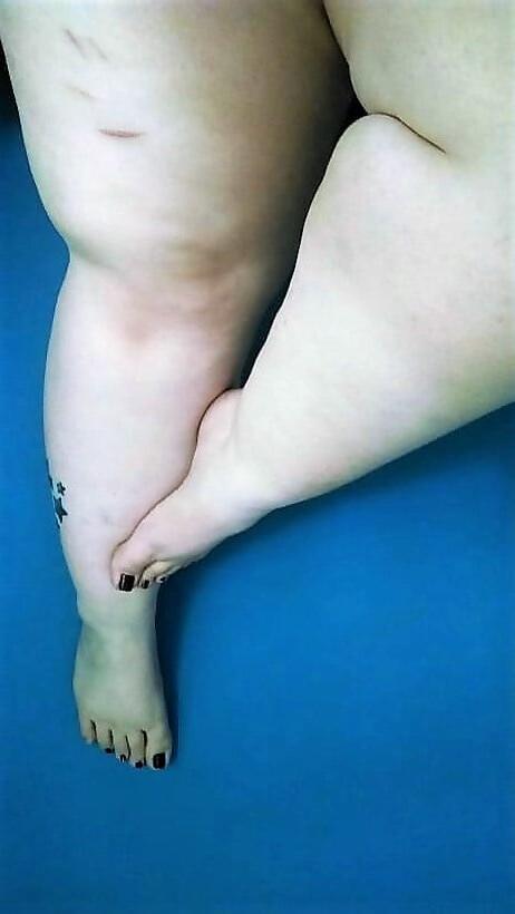 25P Sexy &amp; Chubby Legs 14