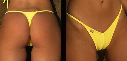 25P Camel Toes