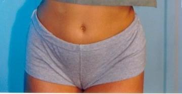 25P Camel Toes