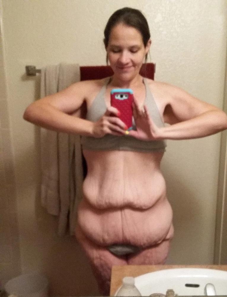 25P Sexy Cellulite filled cute Mommy Tummy soft bellies pt 1.