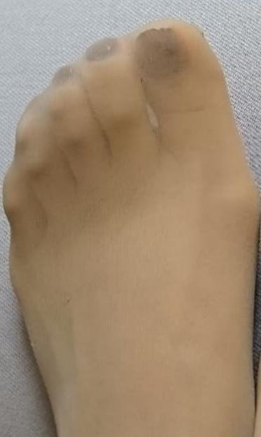 5P Piedini miei num 39 collant vari