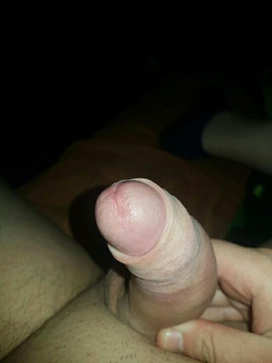 14P Ich