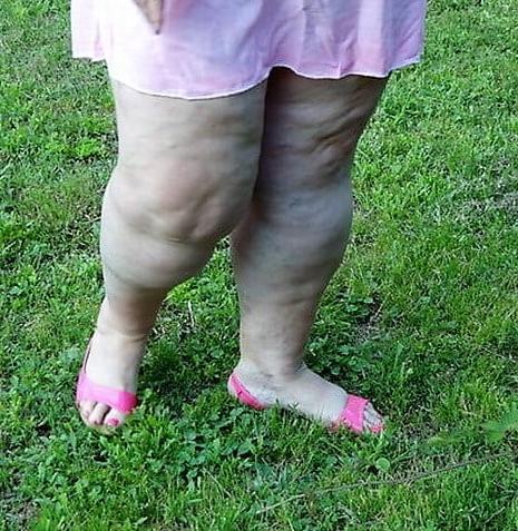 25P Sexy &amp; Chubby Legs 12