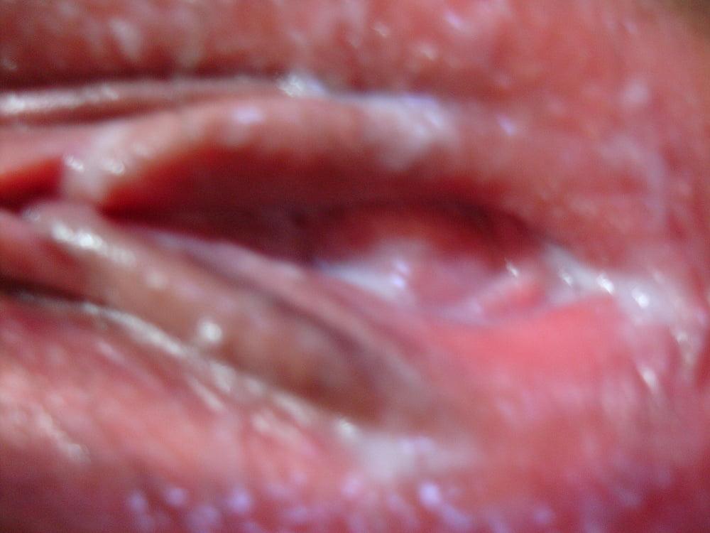 12P Korean Amateur-16
