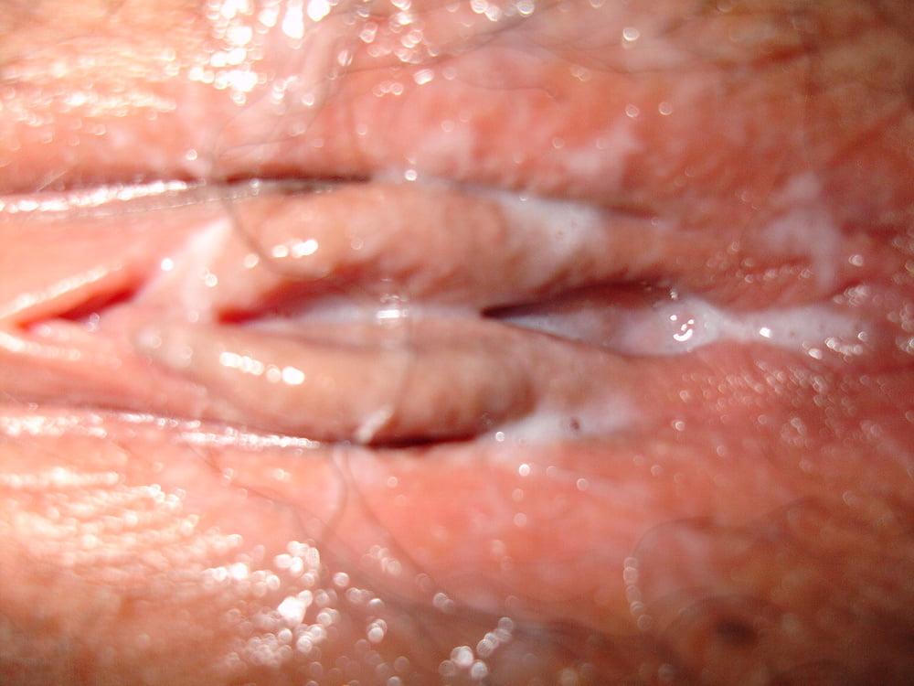 12P Korean Amateur-16