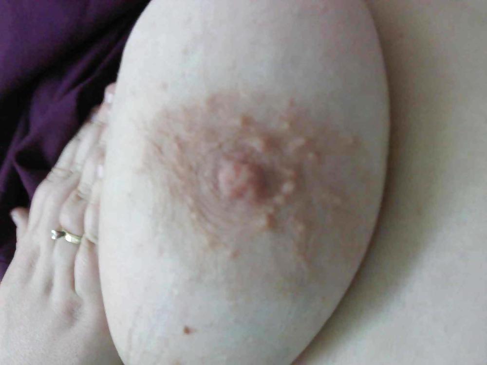 7P Nipple Shots