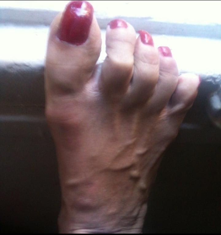 25P red toenails mix (older, dirty, toe ring, sandals mixed).