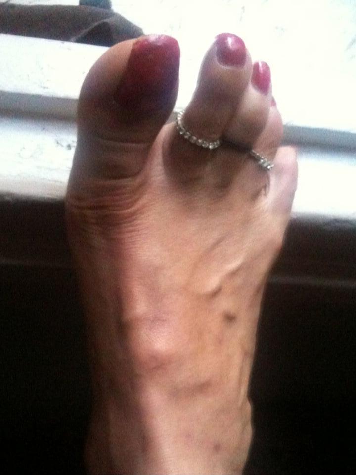 25P red toenails mix (older, dirty, toe ring, sandals mixed).